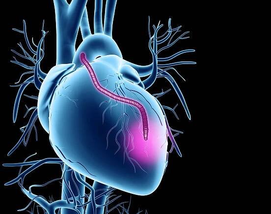 What to Expect During Heart Bypass Surgery