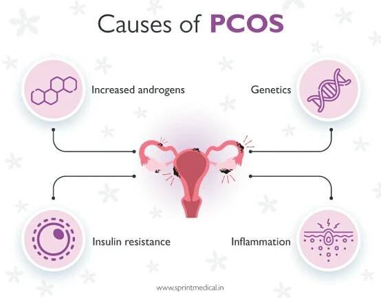 PCOS/PCOD: Causes, Symptoms, and Solutions