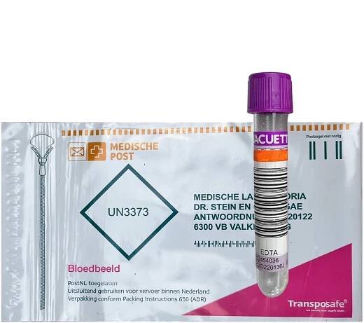 Blood count - Blood value test.co.uk
