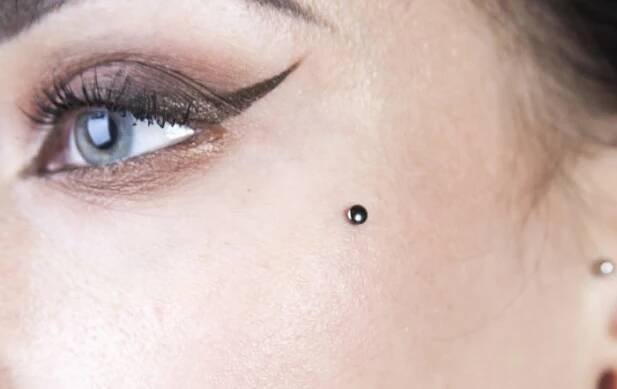 microdermal4