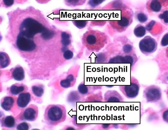 File:Trilineage hematopoiesis, annotated.jpg