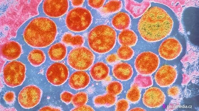 Chlamydie jsou nebezpečnější, než se dosud předpokládalo - Novinky