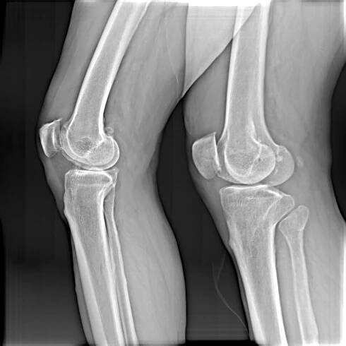 U-Arm Radiology - بهیارصنعت سپاهان