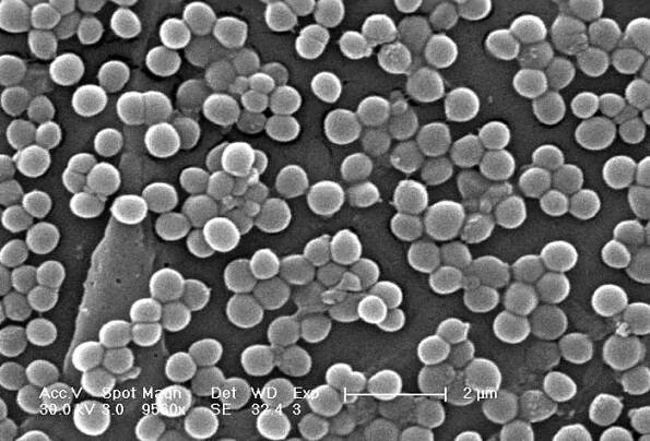 Staphylococcus aureus