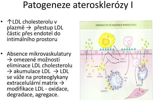 PPT - Ateroskleróza a Stabilní ischemická choroba srdeční PowerPoint Presentation - ID:2107527
