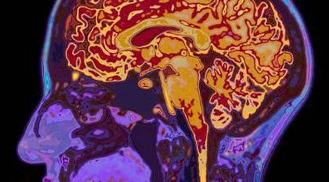 Drugs taken by millions for incontinence, depression and Parkinson’s may increase risk of dementia, finds study