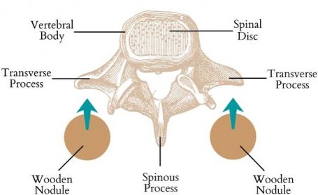 bulging disc diagnosis Archives - Spinal Backrack