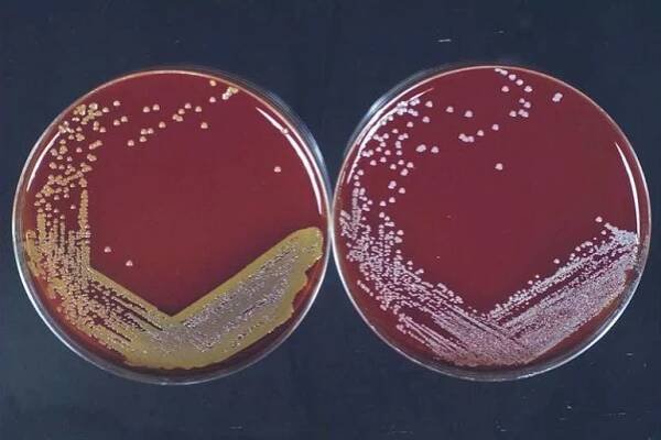 Escherichia coli - Agropress.cz