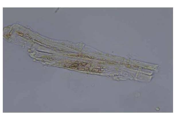 Fig. 2: Powder microscopy of P. hadiensis (glycerol) (4x)  Fig. 3: Powder microscopy of P. hadiensis (glycerol) (40x) 