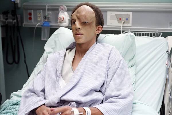 Dr. House - Ošklivec (S04E07) (2007)