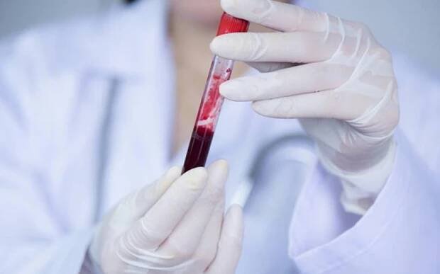 Krevní test odhalí rakovinu čtyři roky před prvními příznaky. Jde o významný krok v boji se zákeřnými nádory - AAzdraví.cz