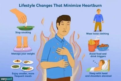 Lifestyle changes that minimize heartburn