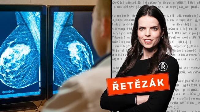 Odrazují ženy od mamografie a ohání se Švýcarskem. Jde o snůšku obyčejných nesmyslů - Novinky