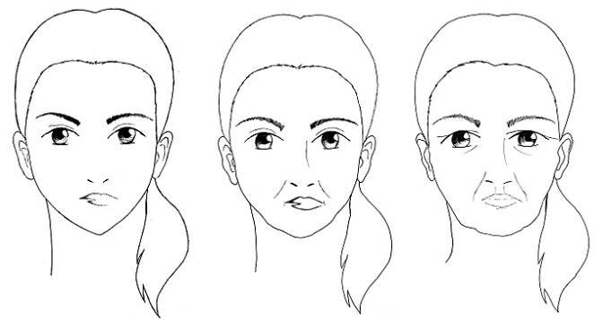 Facelift pomocí nití + video (lifting obličeje a čela) - Zdravé omlazení