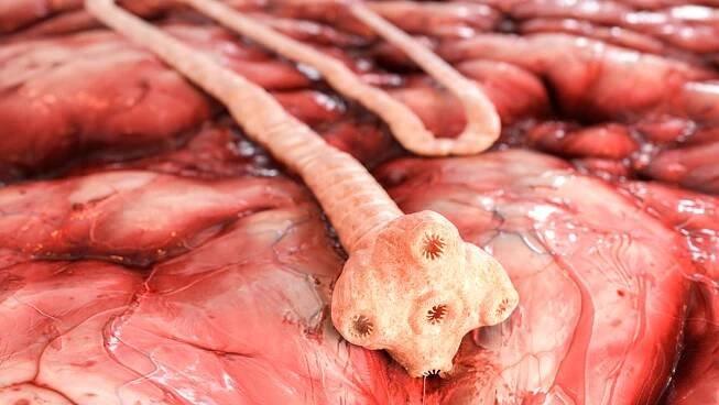 Časné příznaky parazitární infekce v těle, které by neměl přehlížet ani ten největší ignorant