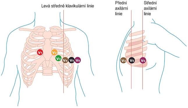 jak naložit hrudní EKG svody