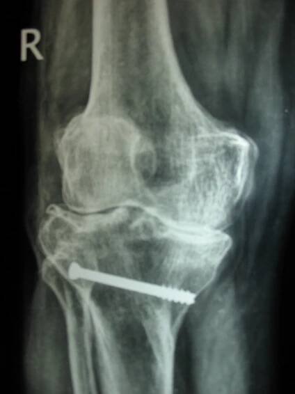 Joints Care in Ahmedabad