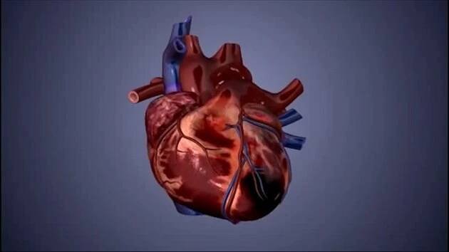 Infarkt, cévní mozková příhoda. Jak tělo chránit před kornatěním tepen