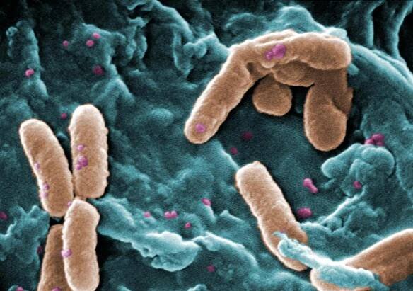 Pseudomonas - Wikiwand
