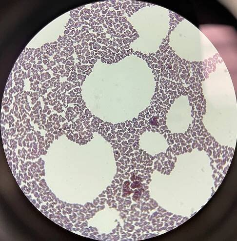 Staphylococcus xylosus