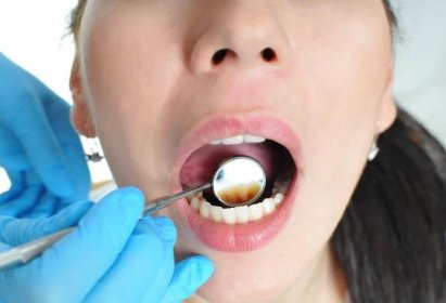 Почему человек не всегда может сказать какой зуб болит