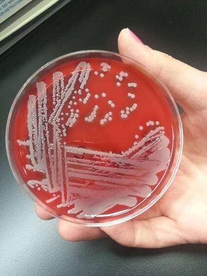 File:Staphylococcus aureus.jpeg - Wikipedia