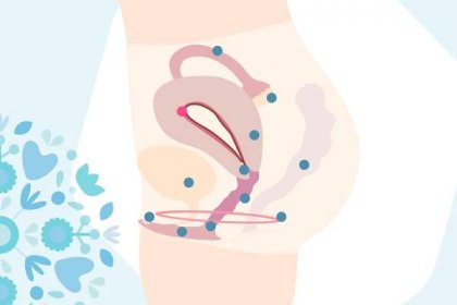 Grafika děložní sliznice