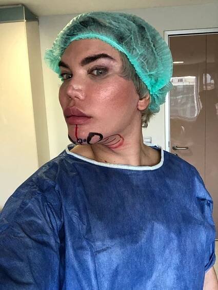 Živý Ken Rodrigo Alves podstoupil další nebezpečnou operaci 2