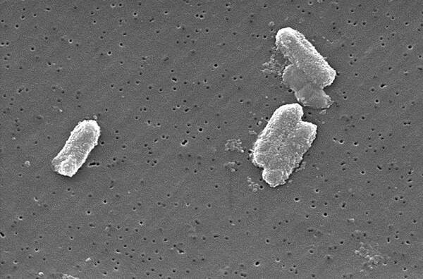 Citrobacter – WikiSkripta