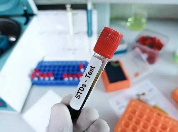 What Are the STD Rates by Country?