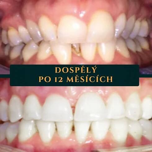 Dentosofie – Informace o celostní péči o úsměv a zdraví zubů