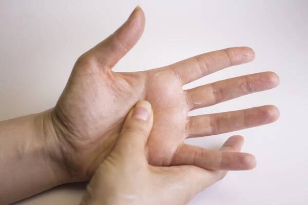 Vaše ruce prozradí skrytou nemoc dřív, než ji odhalí lékař. Naučte se rozpoznat příznaky vážných onemocnění