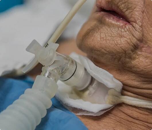 Domácí zdravotní péče | Kyslíková terapie, CPAP, BiPAP, plicní ventilace