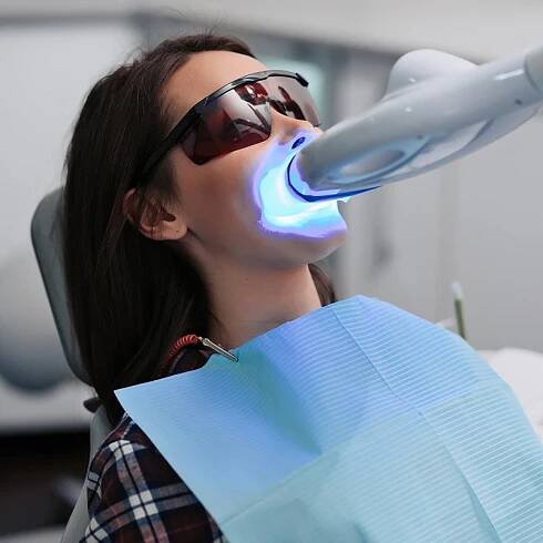 Teeth Bleaching in Vienna