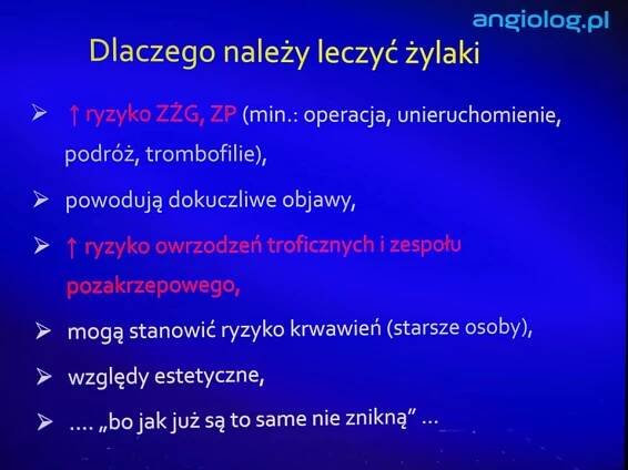 Małoinwazyjna metoda laserowego leczenia żylaków - angiolog.pl