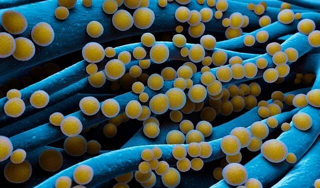 Staphylococcus aureus MRSA