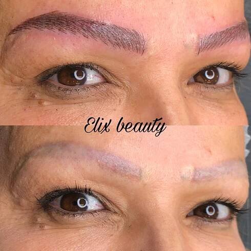 Phibrows - Eyebrows Microblading - Elix Beauty - Eyebrow Microblading & Scalp Micropigmentation, Services and Training by Phi Academy Master