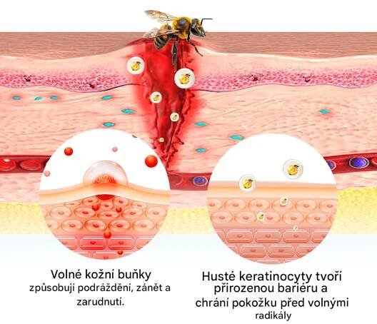 Timilk® BeeLieve Péče o pokožku s lupénkou – My Store