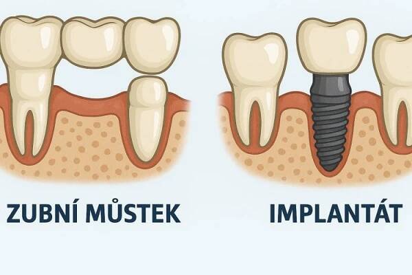 Zubní klinika a dentální hygiena Studio 32 | Praha 10