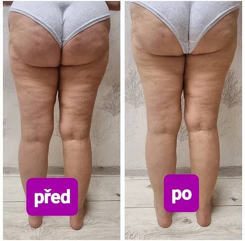 Manuální lymfatická masáž :: Sedmenebe.cz