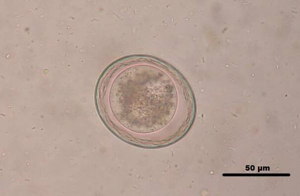 Soubor:Toxocara leonina egg with scale.png – Wikipedie