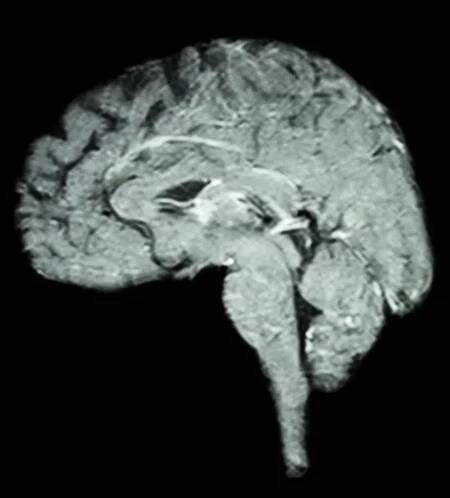 Magnetická rezonance (MRI) mozku (koncepce medicíny, vědy a zdravotnictví ) — Stock obrázek
