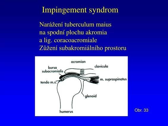 PPT - Entezopatie PowerPoint Presentation, free download - ID:700758