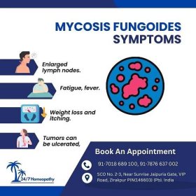 Mycosis Fungoides - 247homeopathy