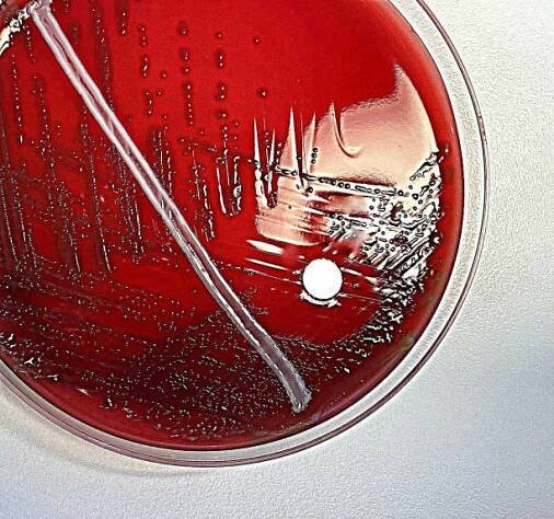 streptococcus pneumoniae zblízka - sepse - stock snímky, obrázky a fotky