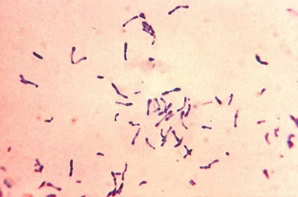 Corynebacterium diphtheriae