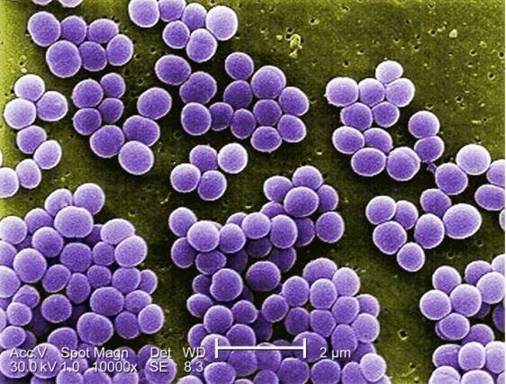 Staphylococcus aureus