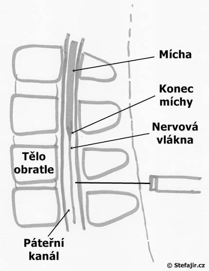 Lumbální punkce | Medicína, nemoci, studium na 1. LF UK