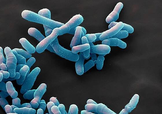 Bakterie Corynebacterium diphteriae, původce onemocnění záškrtu