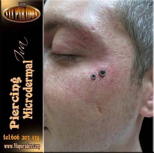 Microdermal - Via Paradox
